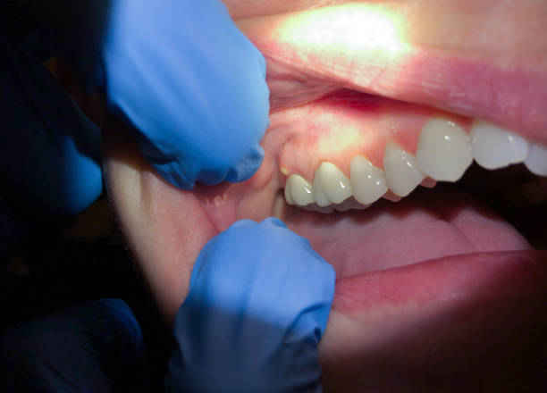 Best Same-Day Emergency Dentist in Morrisville, NC